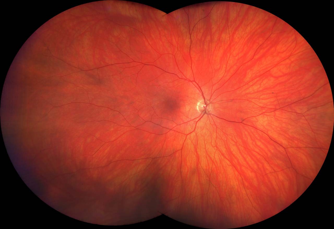 Eye Care River People Health Center